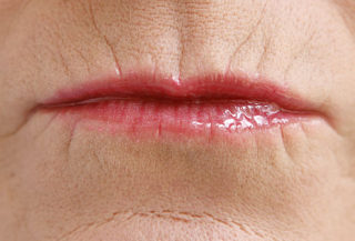 Stock photo of aged lips close up. As we age, we lose volume and fat in the lips.