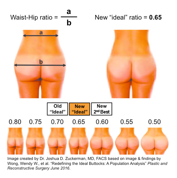 ideal buttock ratio, waist to hip, buttock augmentation, curvier, kim kardashian