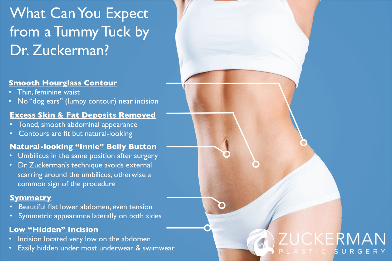 Dr. Zuckerman's Techniques to Achieve the Best Tummy Tuck Surgery Outcomes  – Top Ranked Zuckerman Plastic Surgery